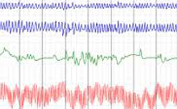 polygraph test chart